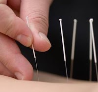 Acupuncture Clinic at Coombe Wing, Kingston Hospital. James Treacher BSc. Hons 724296 Image 1